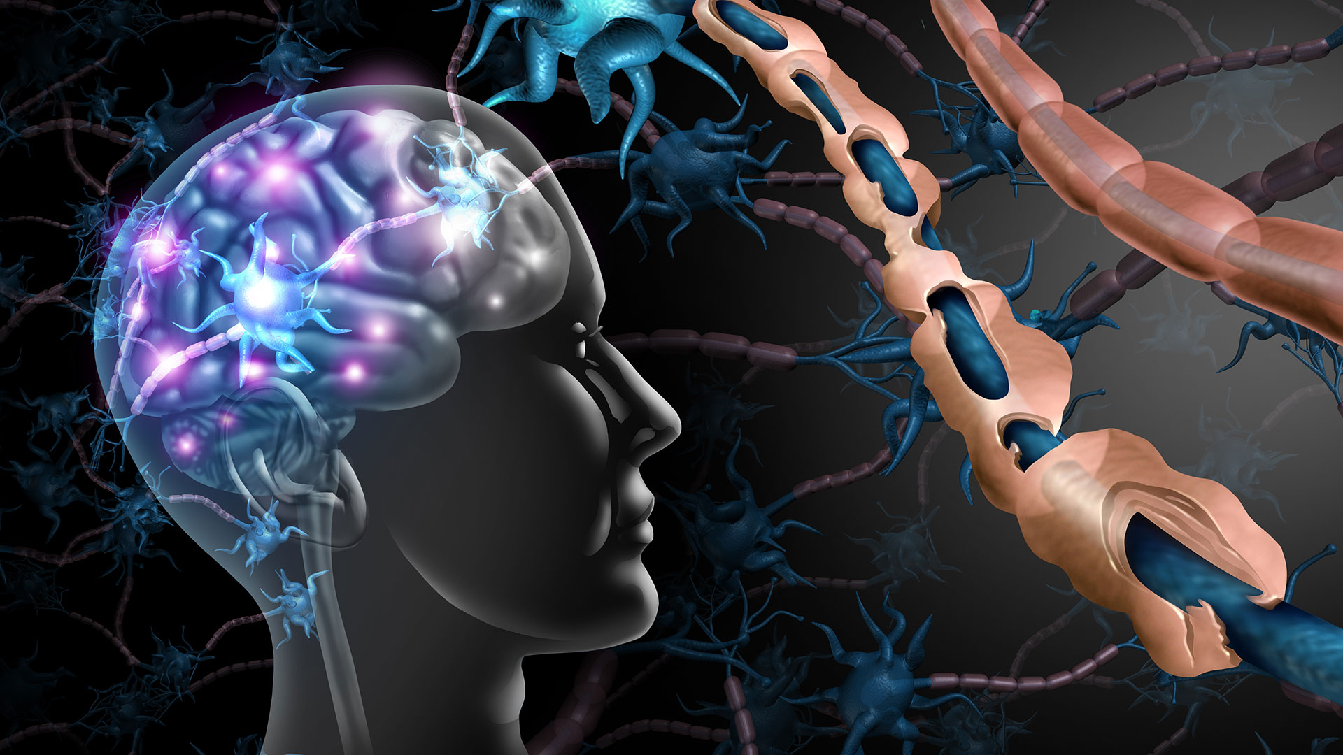 Esclerose múltipla: conheça os sintomas, causas e tratamentos