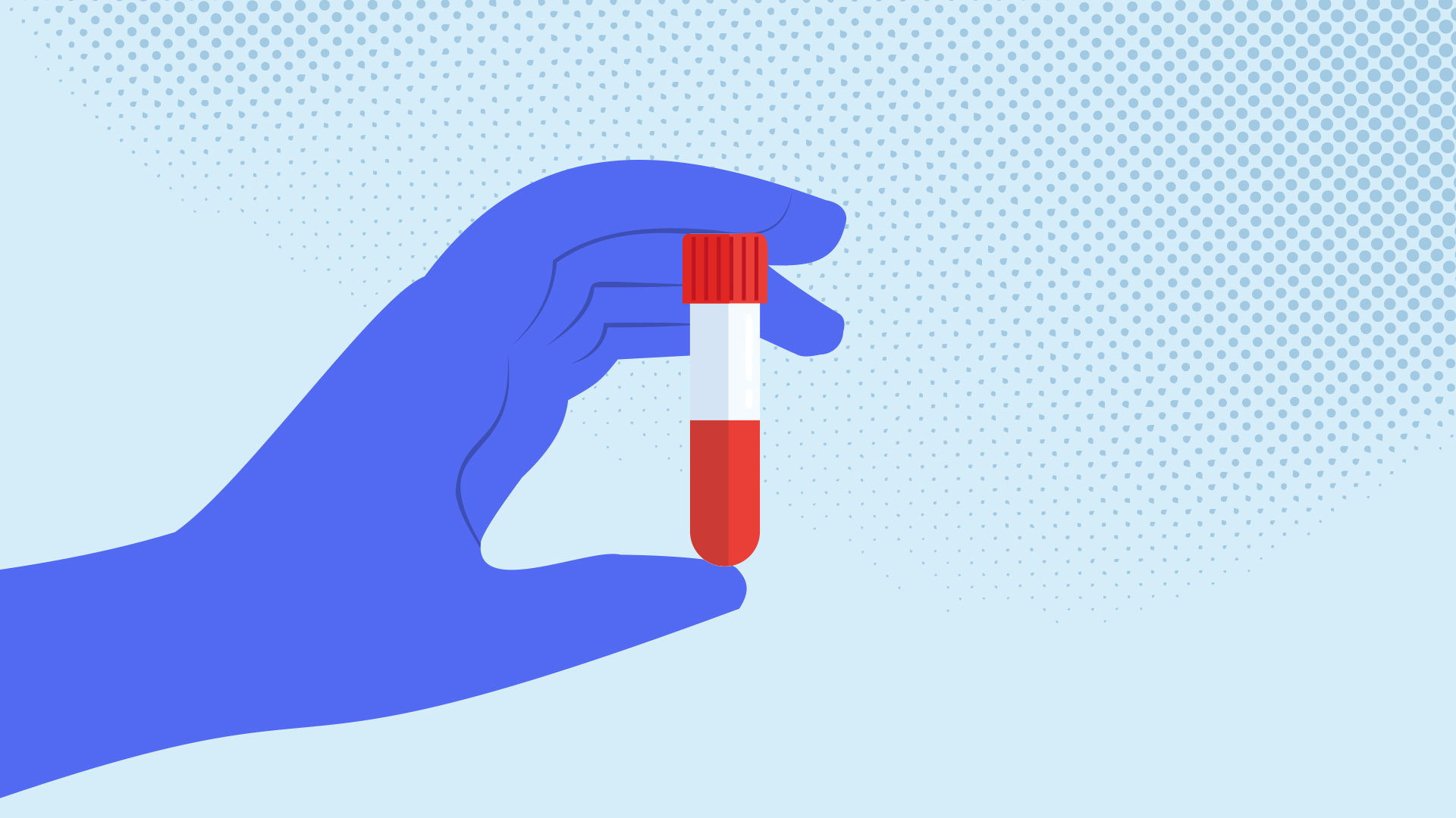 Teste de HIV: conheça os tipos e como funcionam