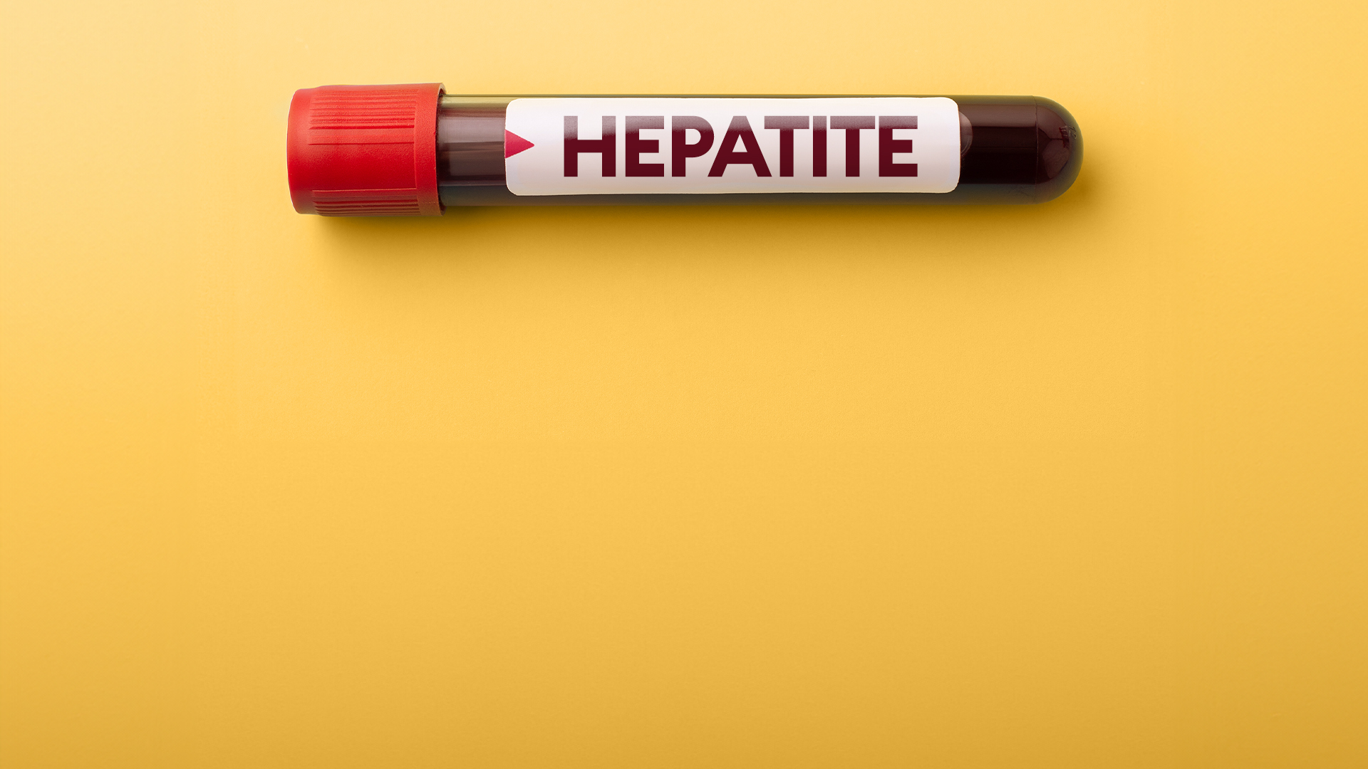 Hepatites virais: conheça os tipos e previna-se!